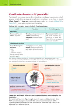 Guide de scanner cardiaque