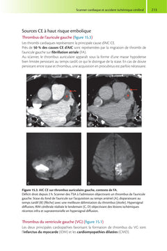 Guide de scanner cardiaque