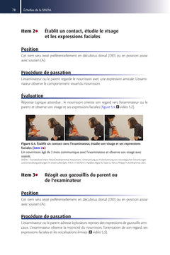 SINDA - Standardized Infant NeuroDevelopmental Assessment