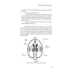 Alzheimer, Parkinson, Charcot... Quand les neurones ne répondent plus