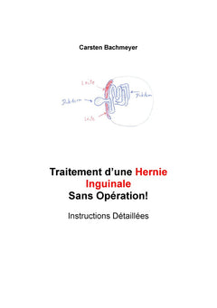 Traitement d'une Hernie Inguinale Sans Opération!