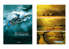 Les Brûlures - histoire complète