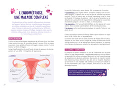 Soulager l'endométriose grâce à une alimentation anti-inflammatoire