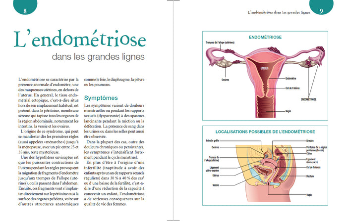 Endométriose & Alimentation - Le régime anti-inflammatoire pour soulager les symptômes