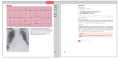 150 cas cliniques d'ECG