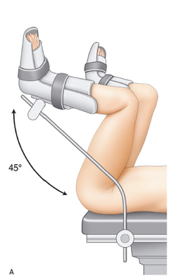 Chirurgie en gynécologie-obstétrique