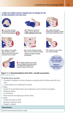 90 fiches de soins - AP auxiliaire de puériculture