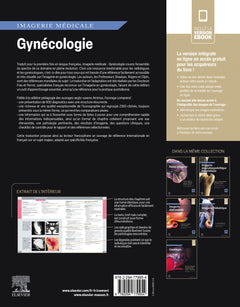 Imagerie médicale : Gynécologie