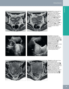 Imagerie médicale : Gynécologie