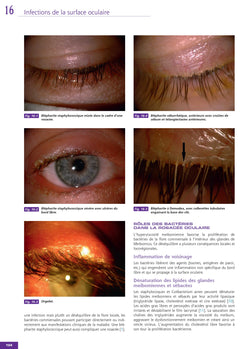 Infections en ophtalmologie