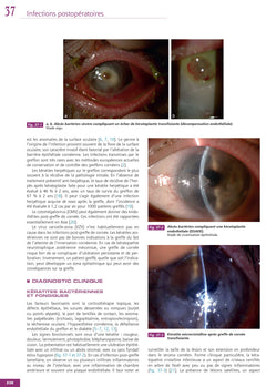 Infections en ophtalmologie