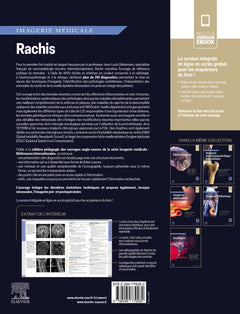 Imagerie médicale : Rachis