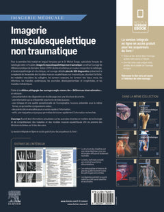 Imagerie musculosquelettique non traumatique
