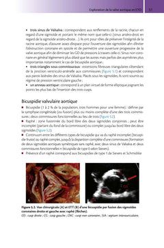 Guide pratique d'échocardiographie transoesophagienne