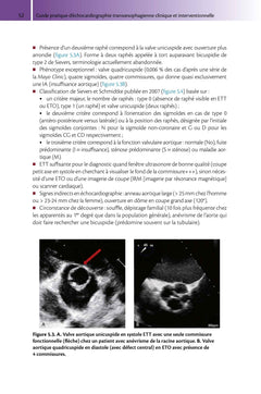 Guide pratique d'échocardiographie transoesophagienne