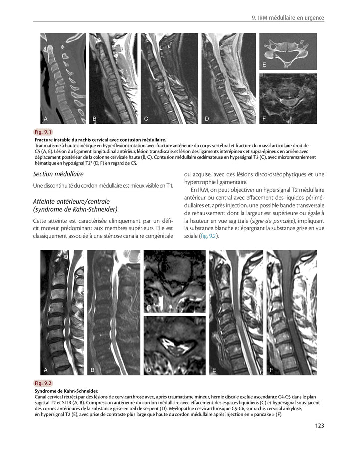 Imagerie des urgences neuroradiologiques