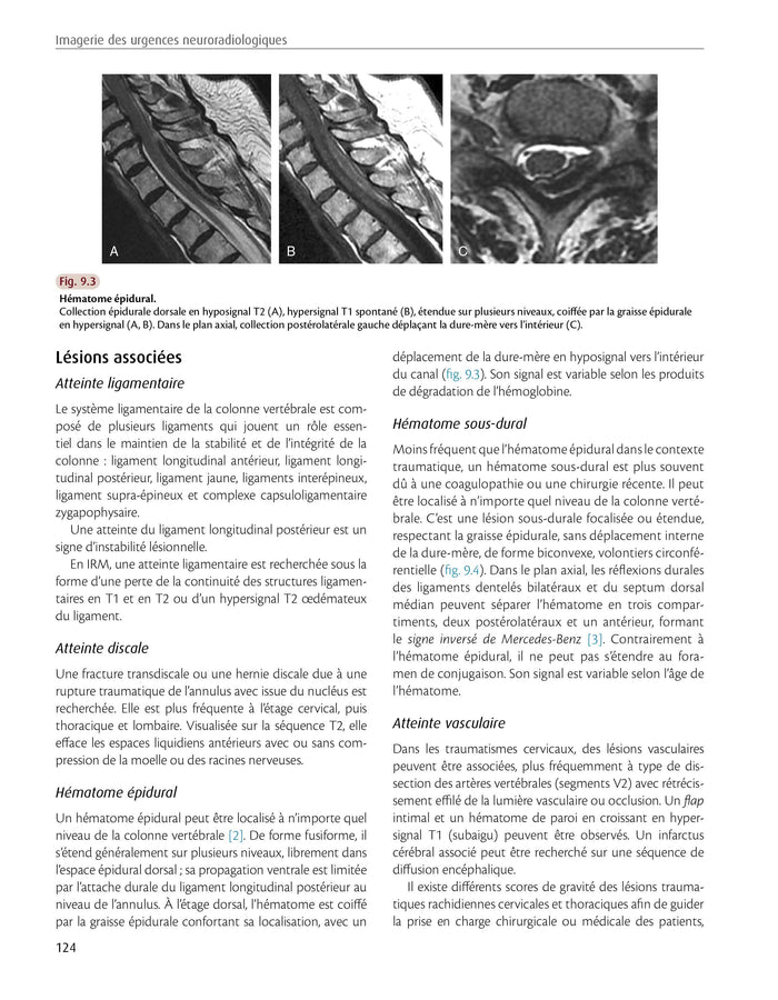 Imagerie des urgences neuroradiologiques