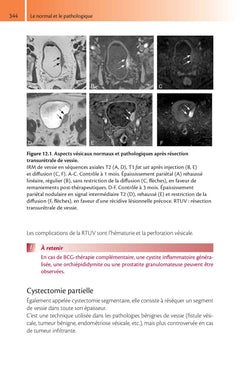 Imagerie de l'appareil urinaire de l'adulte