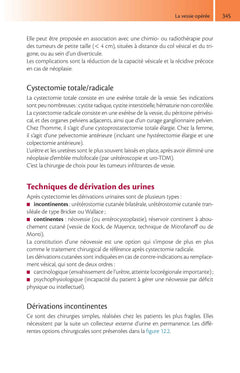 Imagerie de l'appareil urinaire de l'adulte
