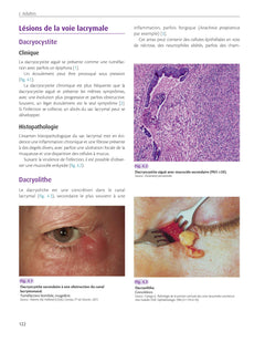 Atlas anatomoclinique en ophtalmologie