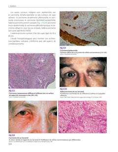 Atlas anatomoclinique en ophtalmologie