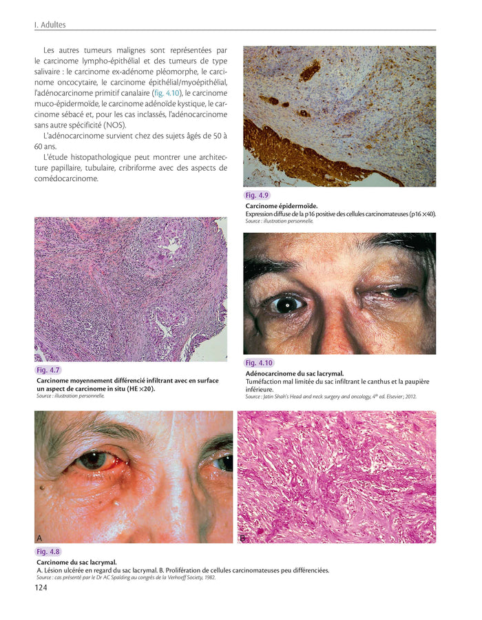 Atlas anatomoclinique en ophtalmologie