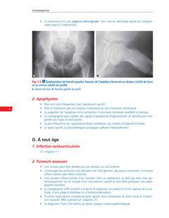 Rhumatologie