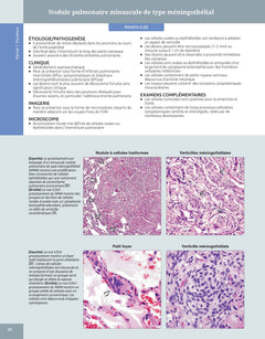 Diagnostic en pathologie thoracique