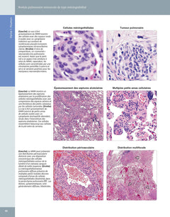Diagnostic en pathologie thoracique
