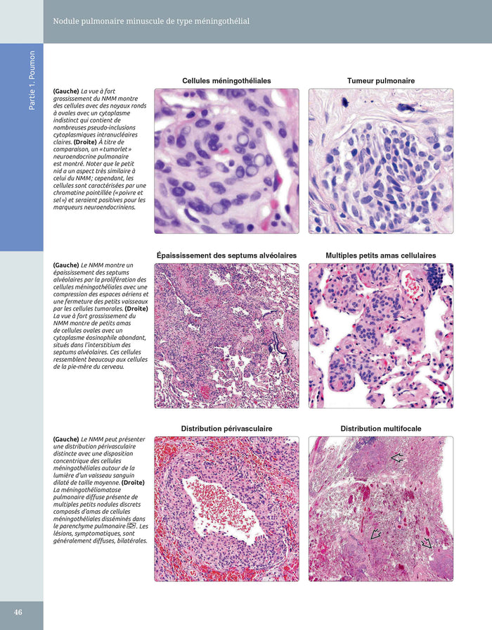 Diagnostic en pathologie thoracique
