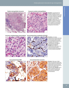 Diagnostic en pathologie thoracique