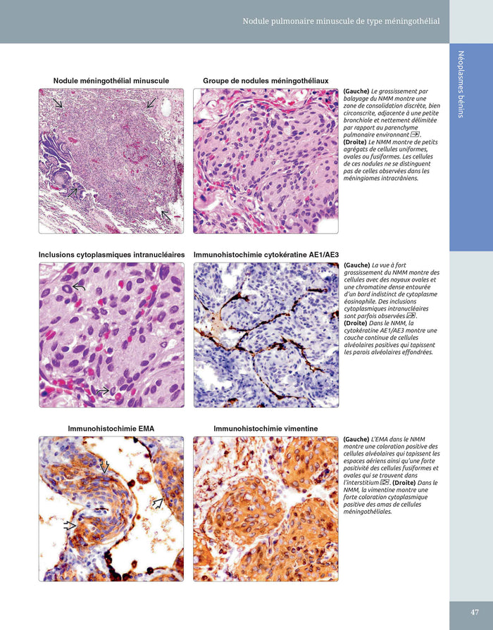 Diagnostic en pathologie thoracique