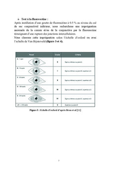 La maladie de la surface oculaire chez le glaucomateux
