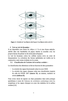 La maladie de la surface oculaire chez le glaucomateux