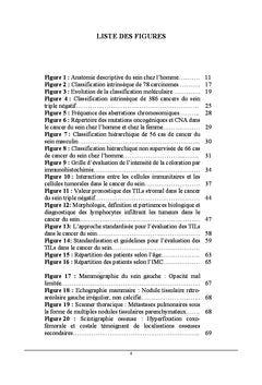 Les lymphocytes infiltrant les tumeurs et cancer du sein chez l'homme