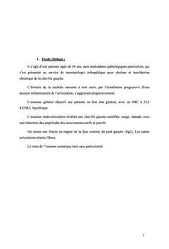La tuberculose osseuse de l'epidemiologie A la prise en charge