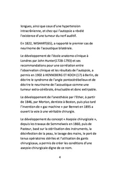 Schwannomes vestibulaires