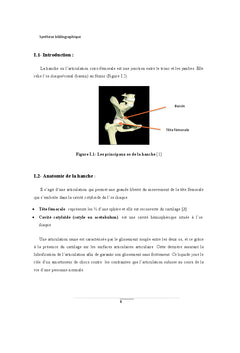 Etude de la prothese total de la hanche