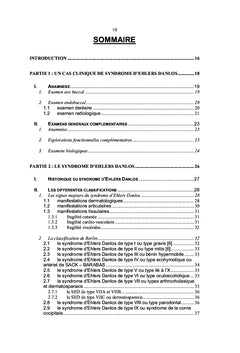 Le syndrome d'Ehlers-Danlos en odonto-stomatologie
