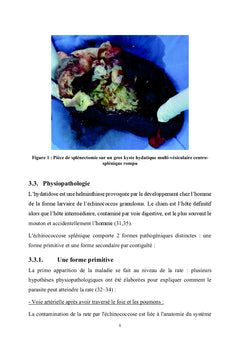 Les Lesions kystiques de la rate