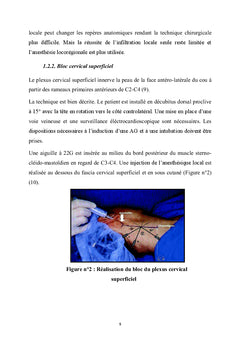 Anesthesie pour chirurgie de la carotide