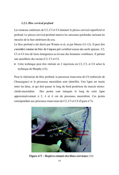 Anesthesie pour chirurgie de la carotide