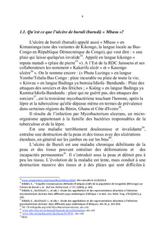 Ulcere de Buruli"Mbasu"