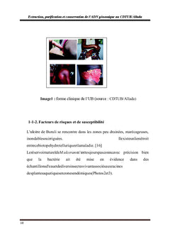 ADN génomique,extraction et purification