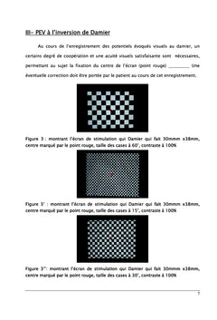 Elaboration des valeurs normales des potentiel evoques visuel