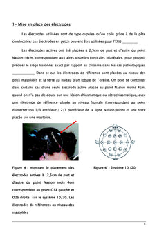 Elaboration des valeurs normales des potentiel evoques visuel