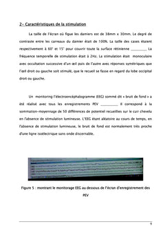 Elaboration des valeurs normales des potentiel evoques visuel