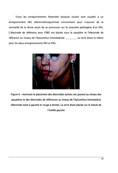 Elaboration des valeurs normales des potentiel evoques visuel