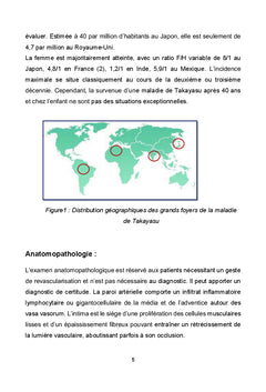 Maladie de Crohn et Takayasu: association fortuite ou filiation?