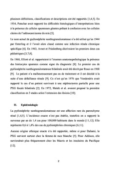 La pyélonéphrite xanthogranulomateuse : du diagnostic au traitement